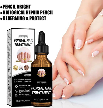 2pcs Nail Care Solution, Improves Brittleness & Discoloration, Cuticle Protection & Strengthening, Repair and Moisturise Nail Nutrient Care Solution, For Toenail And Fingernail