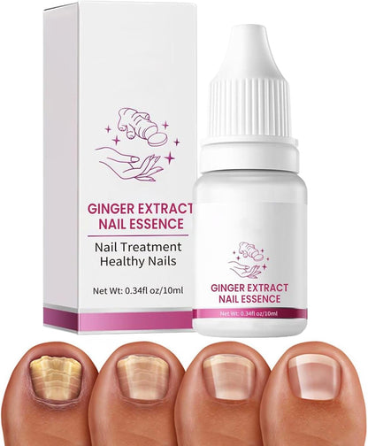 Nail Hardener, Natural Nail Growth Oil, Cuticle Repair and Softener, Strengthening for Foot Care, Fingernails, Yellow and Ingrown Nail Recovery, 10 ml