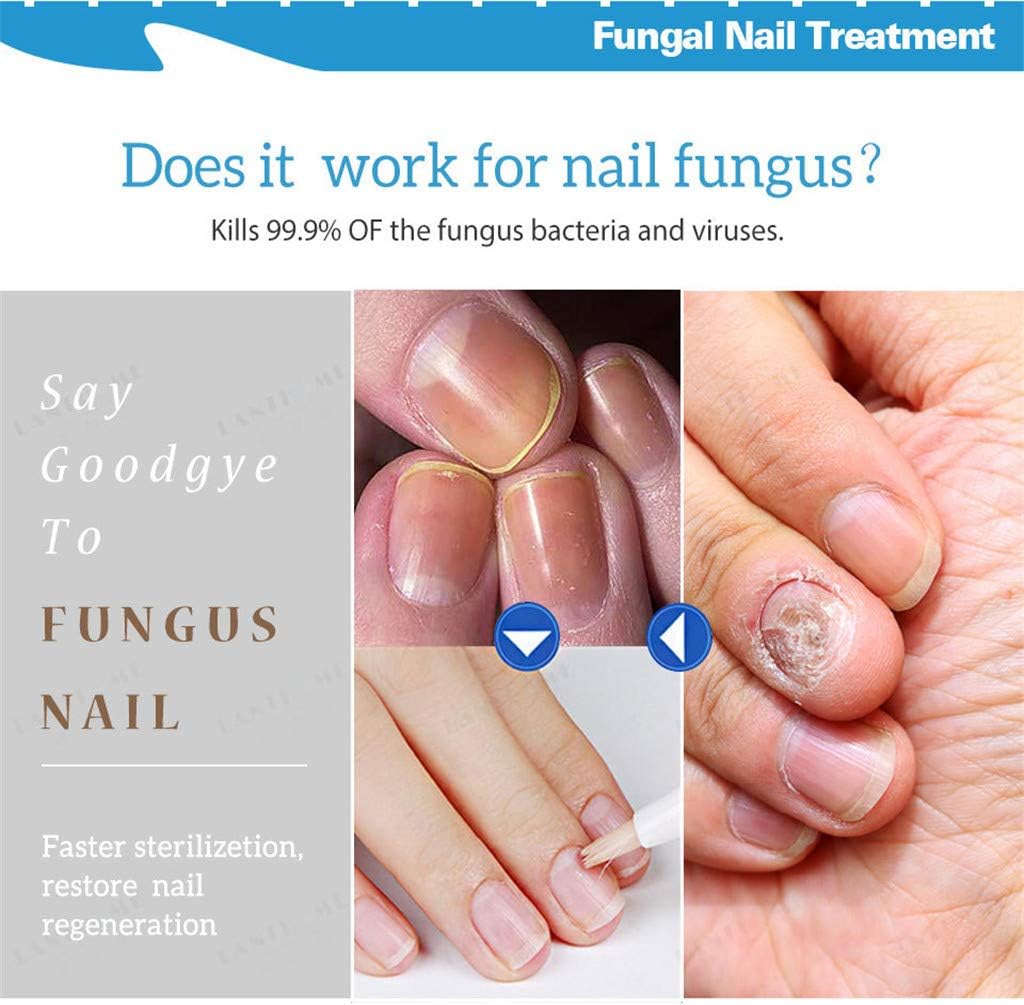 Iwähle Nail Care Nail Care Gel Rain Gel Bio-Pen Nail Care Pen Effective Fragile Nail Repair