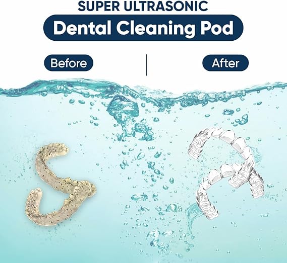 Swissklip ShinePod Ultrasonic Dental Cleaning Pod | Ultrasonic Retainer Cleaner Machine | Mouth Guard Cleaner| Night Guard Cleaner| Aligner Cleaner | Denture Cleaner - White