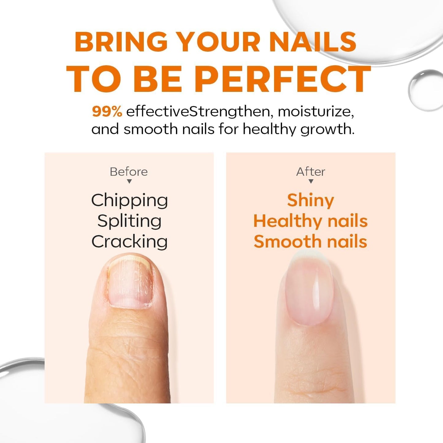Modelones 15ml 8-in-One Nail Ridge Filler Strengthener Base Coat Nail Polish Repair Nail Growth Treatment for Thin and Damaged Nails, Crystal Clear