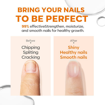 Modelones 15ml 8-in-One Nail Ridge Filler Strengthener Base Coat Nail Polish Repair Nail Growth Treatment for Thin and Damaged Nails, Crystal Clear