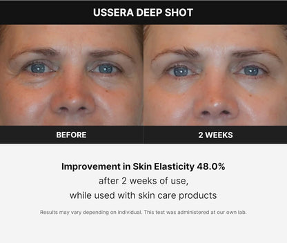 Medicube Age-R USSERA Facial Treatment Device - at-Home Skin Care Device for Collagen Stimulation Wrinkle Reduction, and Youthful Complexion - Korean Skin Care