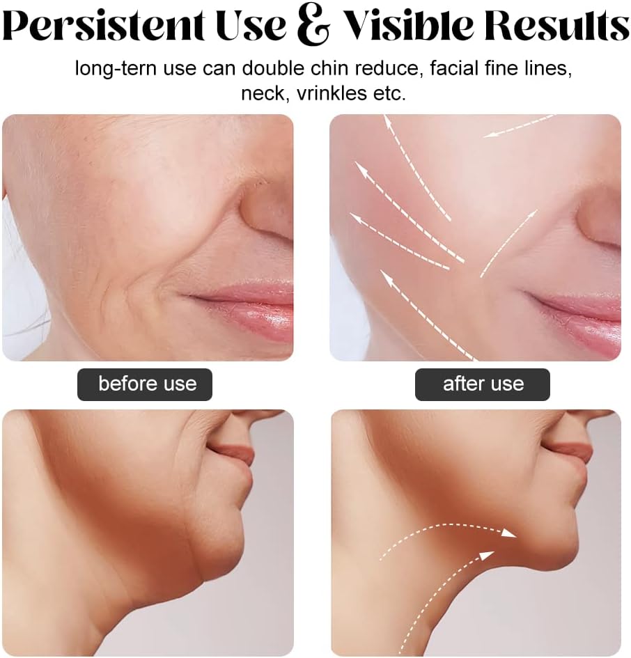 Firming Wrinkle Removal Device for Neck Face, Double Chin Reducer Vibration Facial Massager with Three Uses LED Heat Modes for Skin Care Tightens and Lifts (white)