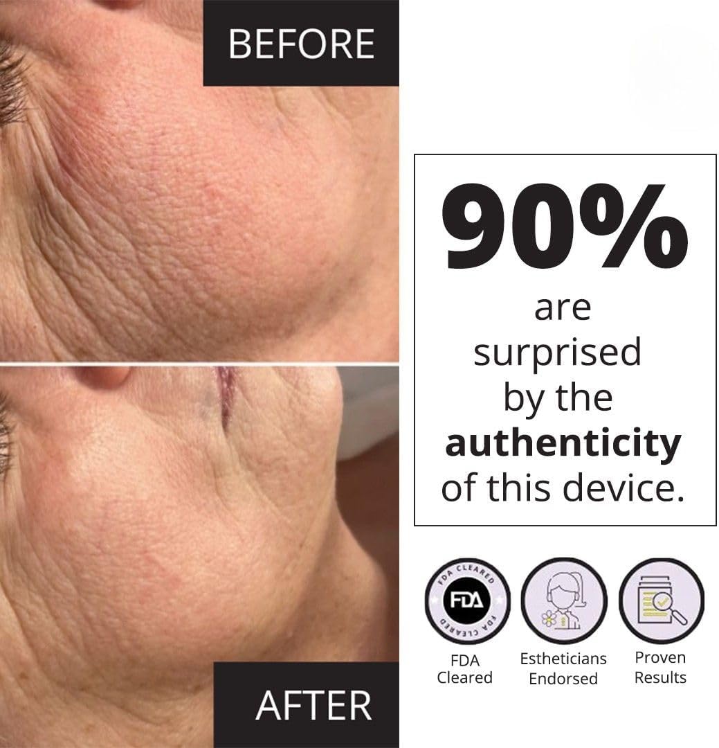 MyoLift Mini Microcurrent Facial Device - Non-Invasive Face Lift, Facial Skin Care Products for Anti Aging, Skin Tightening - Esthetician Supplies and Skin Care Tools - Up to 400 Microamps