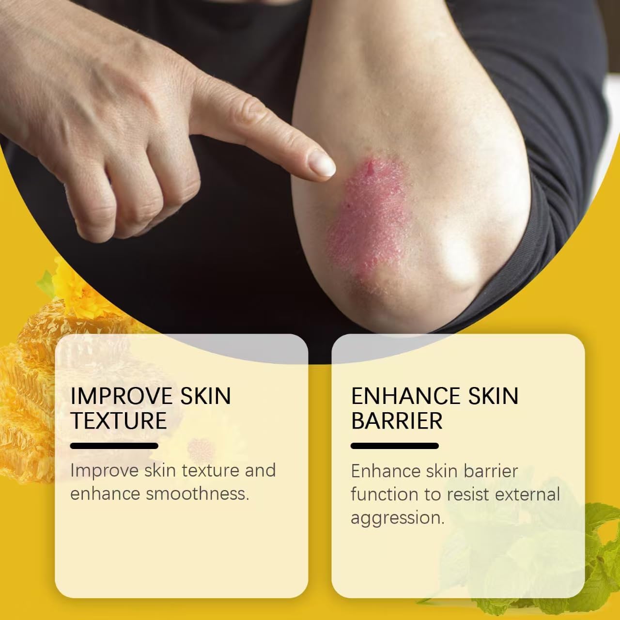 2Pcs Bee Venom Cream,Bee Venom Comprehensive Cream,Bee Venom Wart And Mark Removal Treatment,Face Moisturizer,Anti Inflammatory And Skin Nourishment Cream,Anti Aging Cream