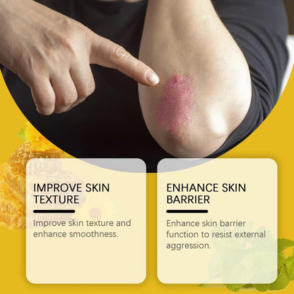 2Pcs Bee Venom Cream,Bee Venom Comprehensive Cream,Bee Venom Wart And Mark Removal Treatment,Face Moisturizer,Anti Inflammatory And Skin Nourishment Cream,Anti Aging Cream