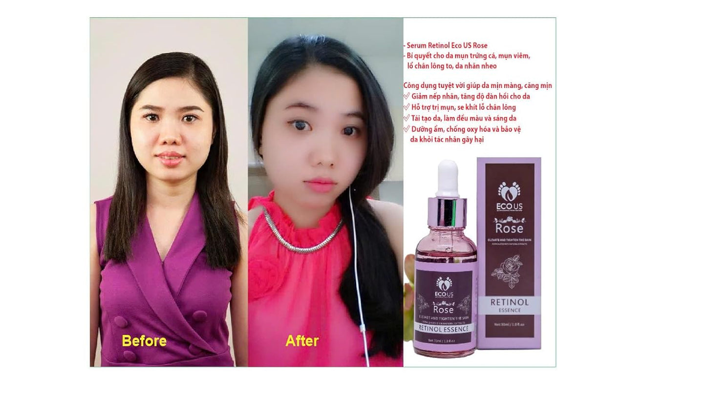 Rose Retinol Lifting Serum - Anti-Aging Serum with Retinol for more Smooth