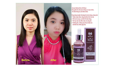 Rose Retinol Lifting Serum - Anti-Aging Serum with Retinol for more Smooth