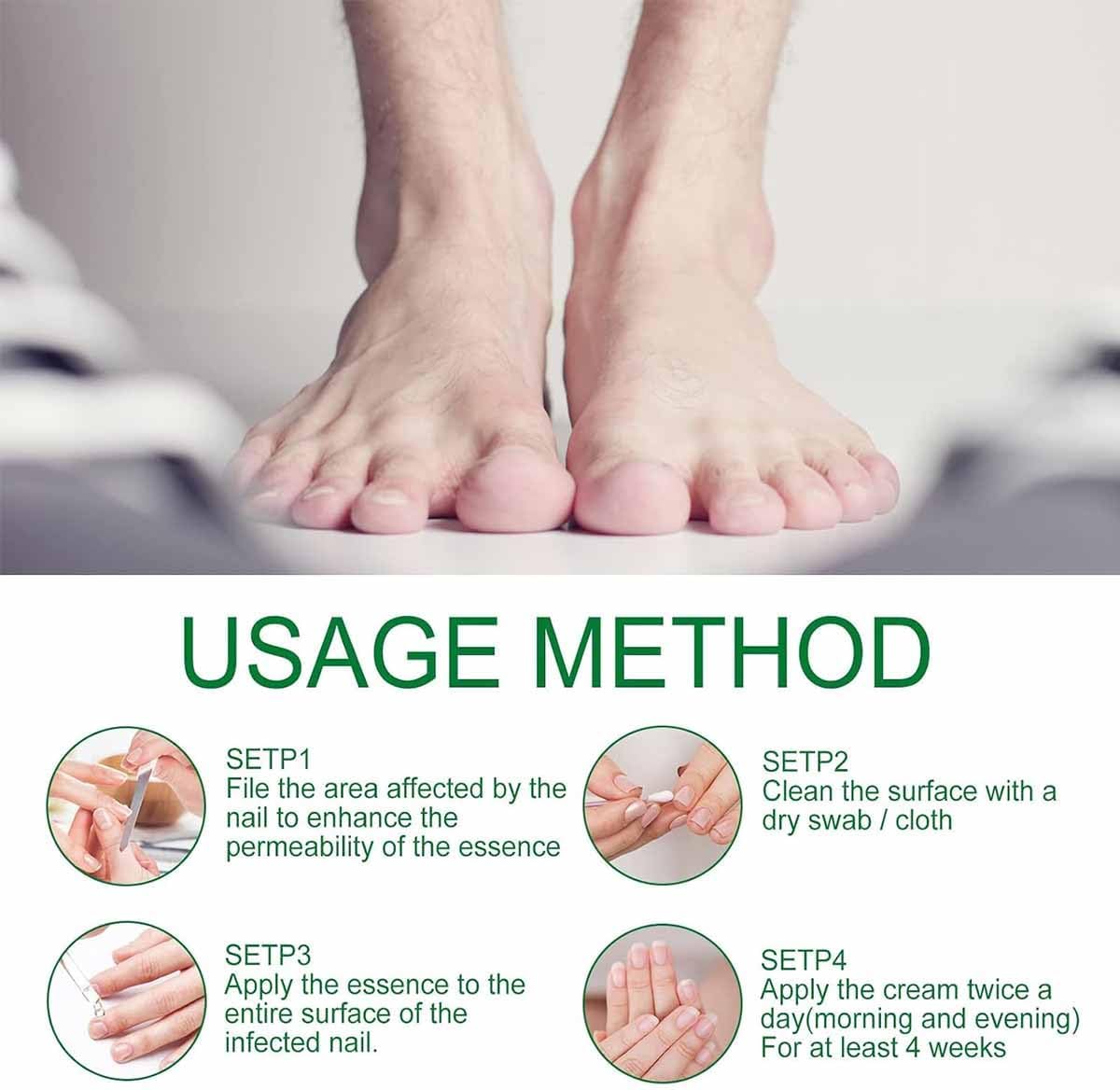 Nailshield Anti Fungal Stick, Anti Fungal Stick Roll On, Fungal Nail Repair Stick, Natural Nail Strengthener, Say Goodbye To Nail Fungus, For Nail Care Serum, Prevents Hangnails And Dryness (2)