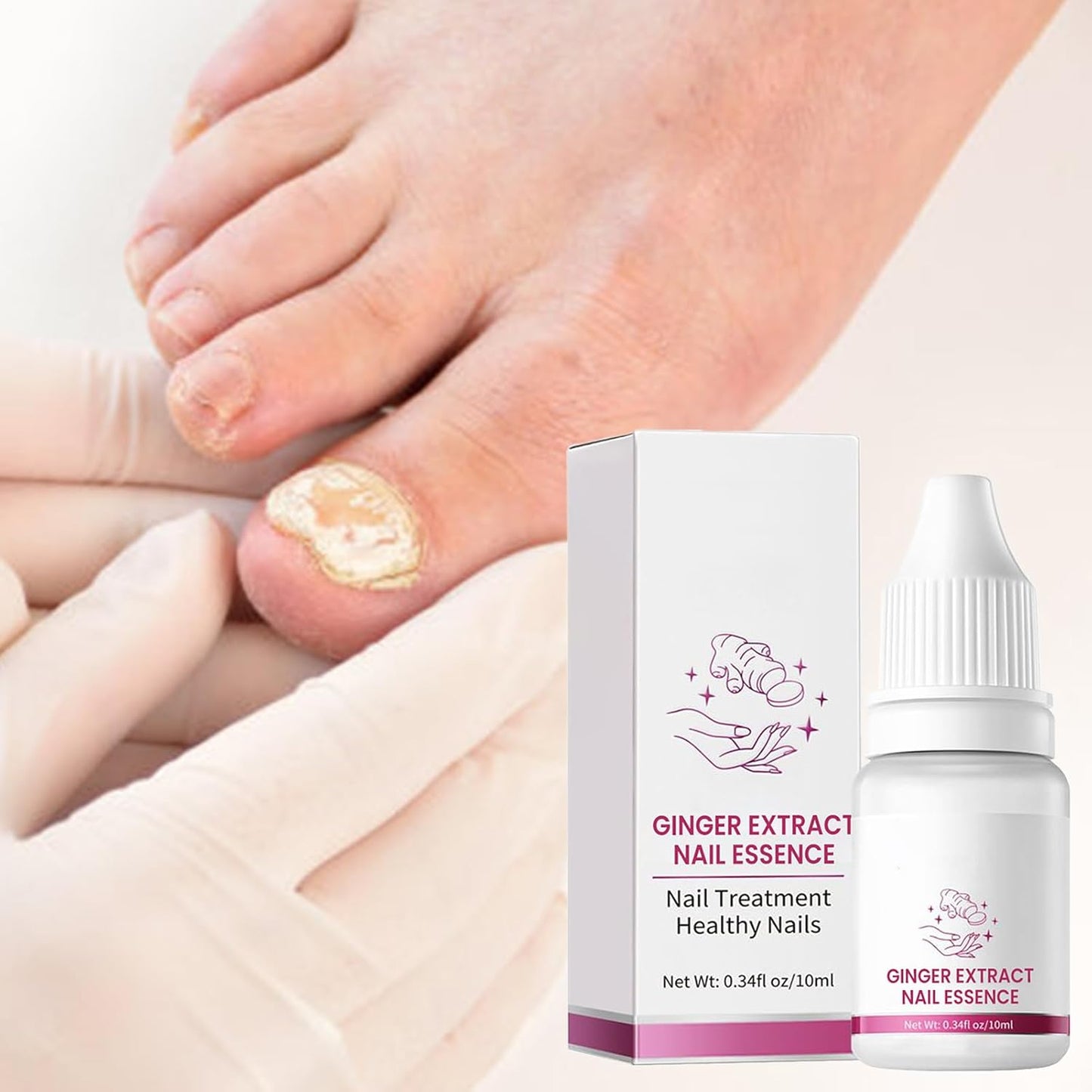 Nail Hardener, Nail Nutrient Oil, 10 ml Natural Cuticle Oils Repair Softener, Optimal Nail Revitalization, for Foot Care, Fingernails, Yellow Toenail, Men Ingrown, Women and