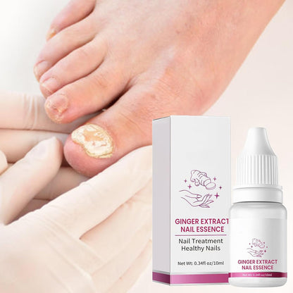 Nail Hardener, Nail Nutrient Oil, 10 ml Natural Cuticle Oils Repair Softener, Optimal Nail Revitalization, for Foot Care, Fingernails, Yellow Toenail, Men Ingrown, Women and