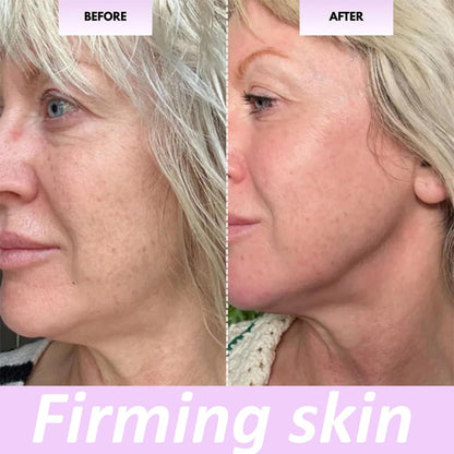 Rullo Di Bellezza Elarique, Rullo for Il Viso Glow Sculpt, Rullo Di Bellezza, Strumento Di Massaggio for Il Viso Con 24 Pietre Di Tormalina, Rullo in Lega Di Alluminio for La Luminosità Di Viso