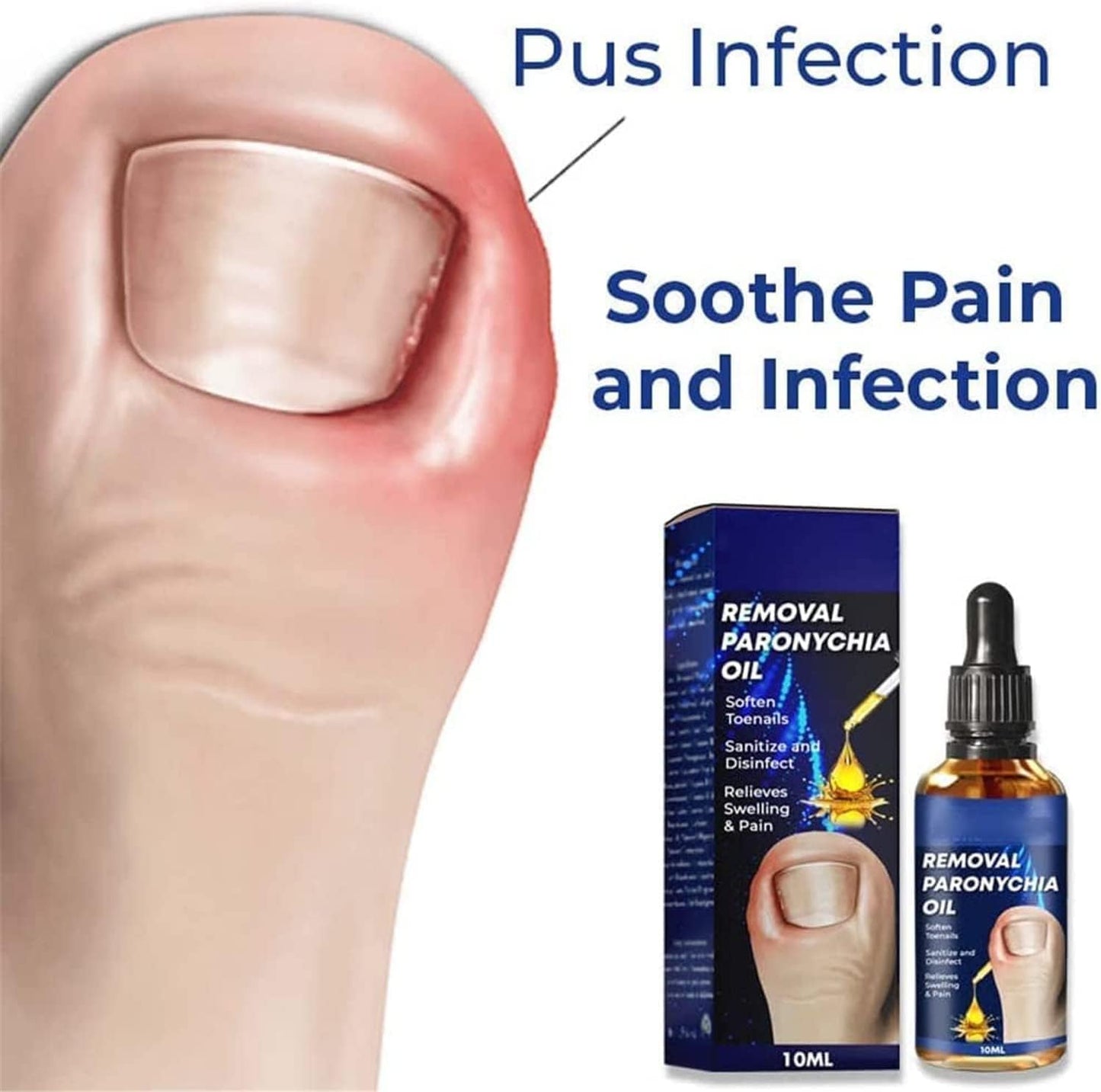 German Toenailcare Removal Paronychia Oil, Care Oil for Removing Paronychia, Toenail Treatment Best Nail Repair Solution,Nail Renewal Liquid for Damaged & Discoloration Nail (2 Pieces)