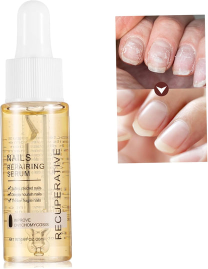 Baluue Nail Strengthener 20ml Nails Repairing Serum for Nail Care Treatment Liquid
