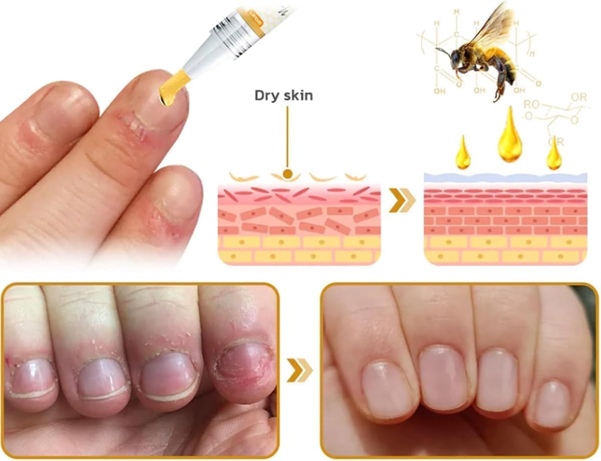 3Pcs Nailplus Strong 7 Days Growth Nail Gel,Nail Growth and Repair Serum,Nail Growth and Strengthener Essence,Nail Strengthener for Damaged Nails