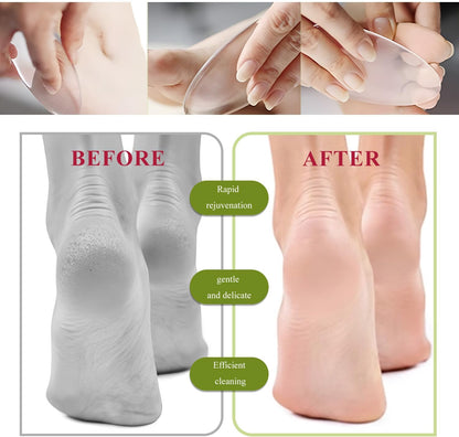 TORMEN Glass Foot File, 2 PCS Glass Nail File and Foot Rasp, Glass Nail File,Dead Skin Exfoliator with Nano Micro-Abrasive Particles, Hard Skin Remover for Wet and Dry Foot Care,Nail Care