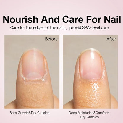 Nail Cuticle Oil, Fingernail Care Set, 15ml Mild Cuticles Repairing, Product Nourishing, Formula for Home Use, Damaged Fingernails Caring, Moisturizing, Daily, Women