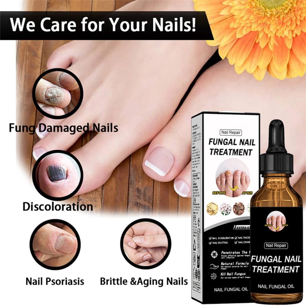 2pcs Nail Care Solution, Improves Brittleness & Discoloration, Cuticle Protection & Strengthening, Repair and Moisturise Nail Nutrient Care Solution, For Toenail And Fingernail