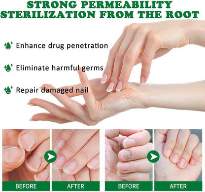 Nailshield Anti Fungal Stick, Anti Fungal Stick Roll On, Fungal Nail Repair Stick, Natural Nail Strengthener, Say Goodbye To Nail Fungus, For Nail Care Serum, Prevents Hangnails And Dryness (2)