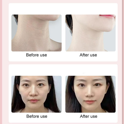 Face and Neck Massager, Neck Tightening Device, Electric Facial Massager, Neck Tightening Device, Face Neck Massager, Skin Care Tool for Women