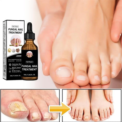 2pcs Nail Care Solution, Improves Brittleness & Discoloration, Cuticle Protection & Strengthening, Repair and Moisturise Nail Nutrient Care Solution, For Toenail And Fingernail