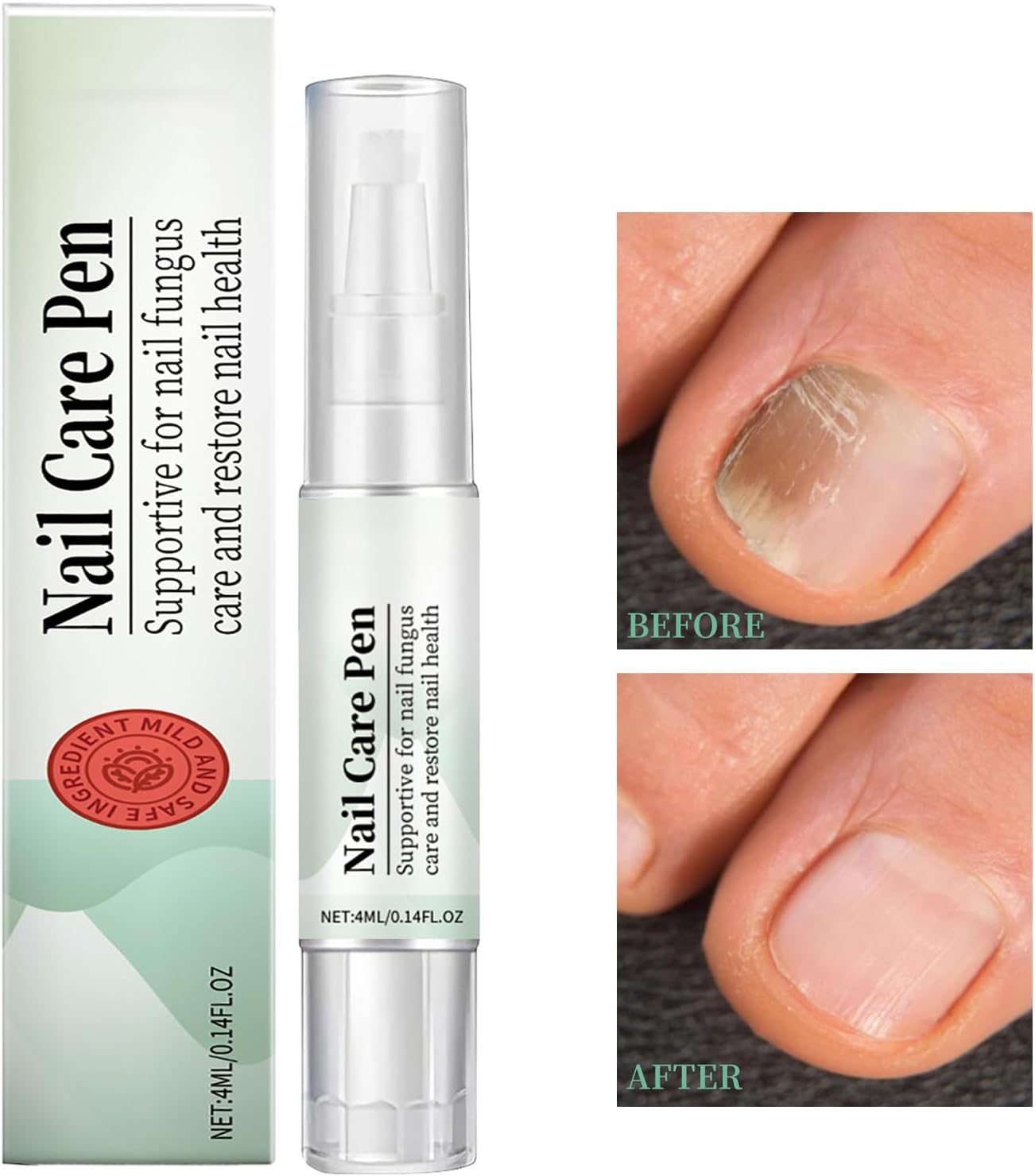 Nail Care Pen, The Original Nail Fungus Infection Cosmetic Care Pen Fast and Effective for Well-Groomed Nails with Tea Tree Oil, Vitamin E and