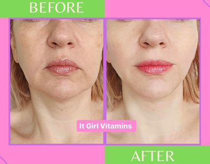 Glowing Skin Collagen Gummy, Hydrated, Youthful Skin, Hyaluronic Acid, Peptides, Retinol, Sea Moss, Vitamins & Antioxidants for Anti-Aging, Acne, Skincare, Beauty Gummies for Women, Organic & Vegan