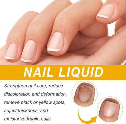 3Pcs Nailplus Strong 7 Days Growth Nail Gel,Nail Growth and Repair Serum,Nail Growth and Strengthener Essence,Nail Strengthener for Damaged Nails