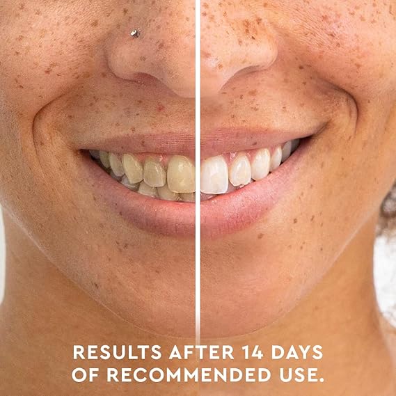 MOON Teeth Whitening Pen - Gentle on Sensitive Teeth, Whitens with Antioxidants & Essential Oils - Vegan Whitening Gel in an Easy Applicator - Vanilla Mint