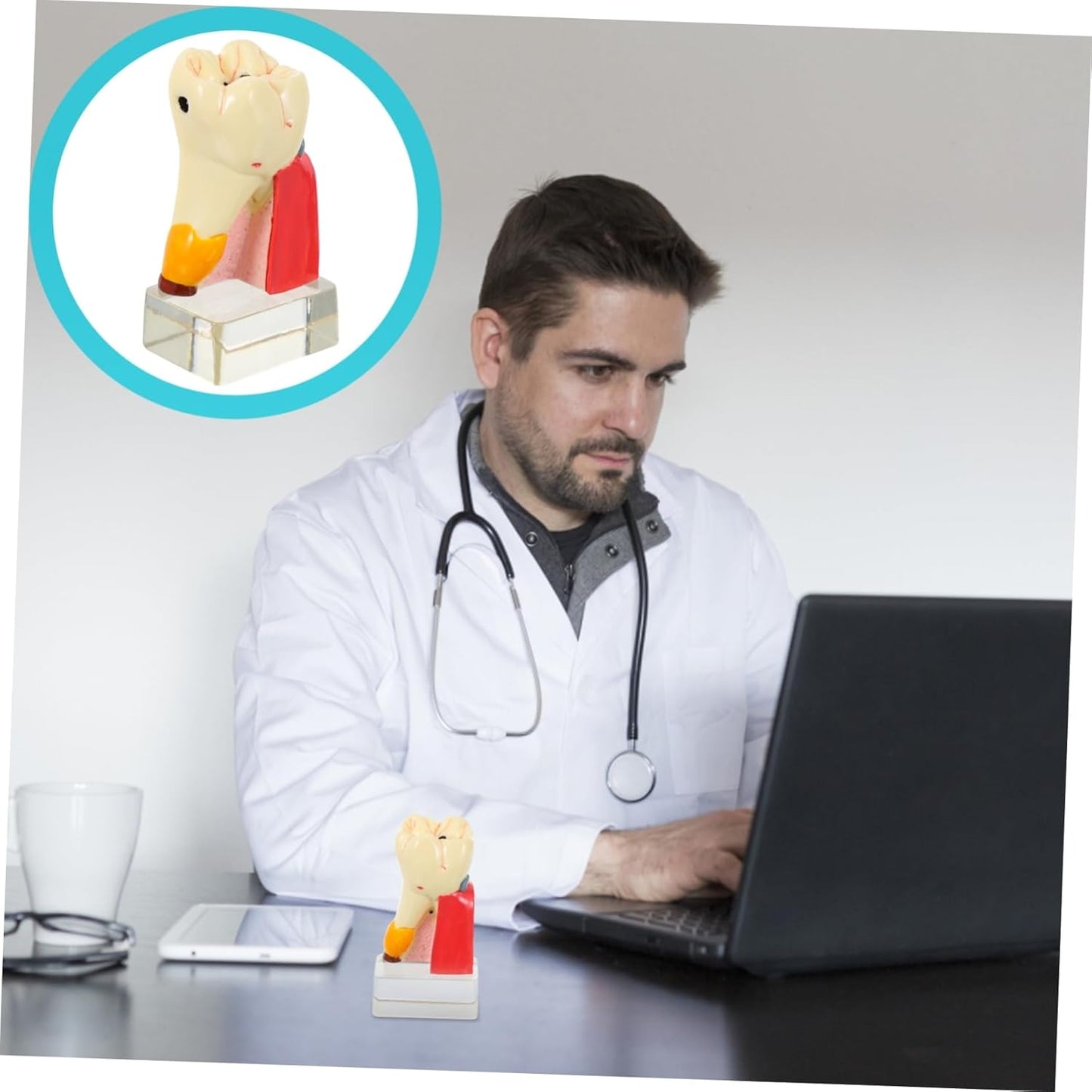 KICHOUSE 4 Caries Model Tooth Model Demonstration Model Teeth Model Teaching Oral Model Toy Teeth for Teeth Models for Education Model