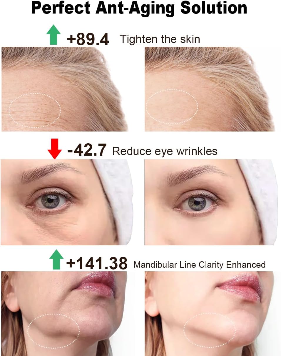 Radio Frequency Skin Tightening Device, 3-in-1 Microcurrent Facial Machine Face Massager LED Anti Aging Wrinkle Reduction, Enhanced Absorption, Radiance, Elasticity, Pore Care Korean Skin Care