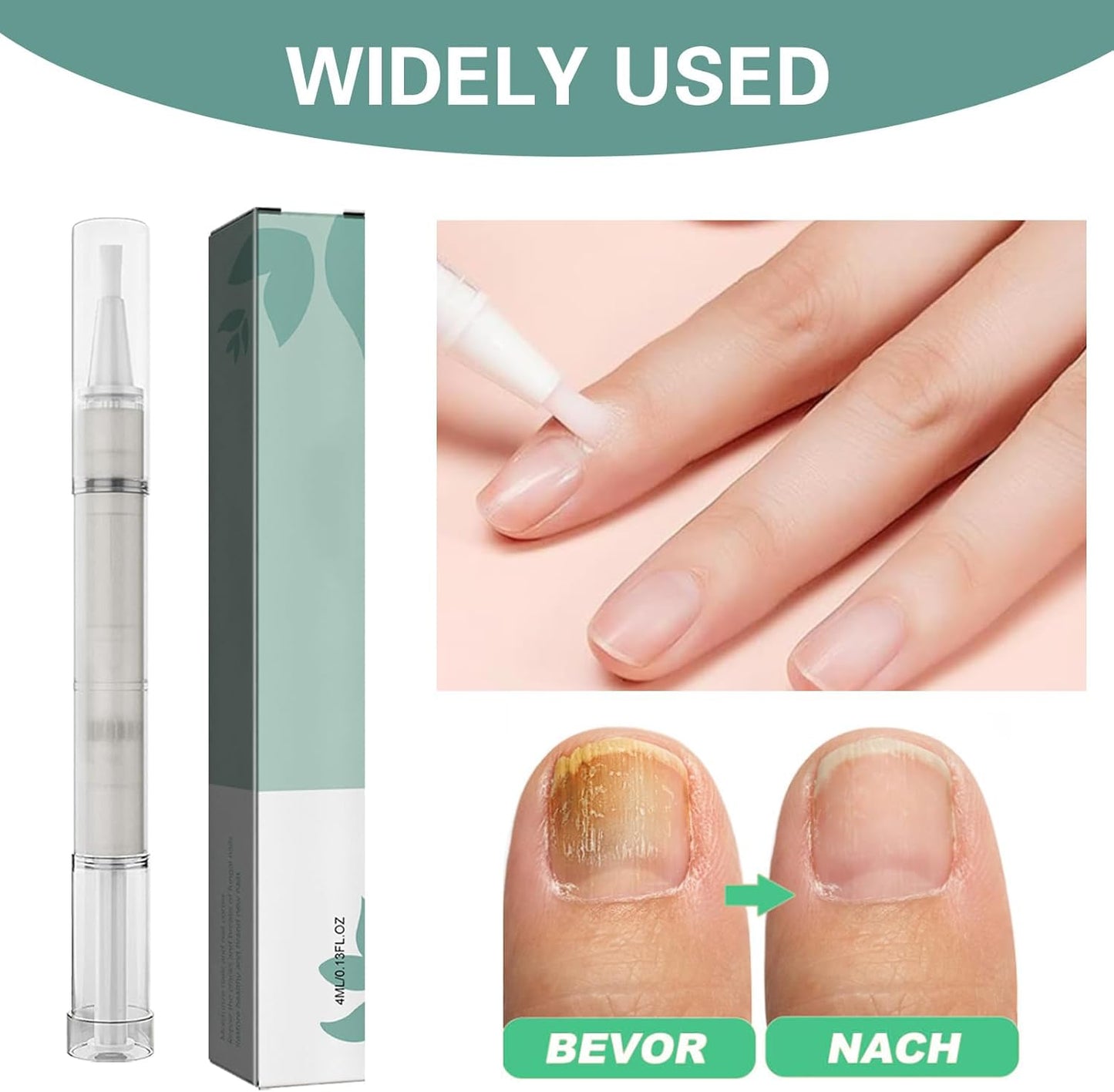 4 Pieces Nail Care Oil Pen, Nail Care Oil Pen Nourishing, Nail Moisturizer Oil, Deeply Moisturizes and Nourishes