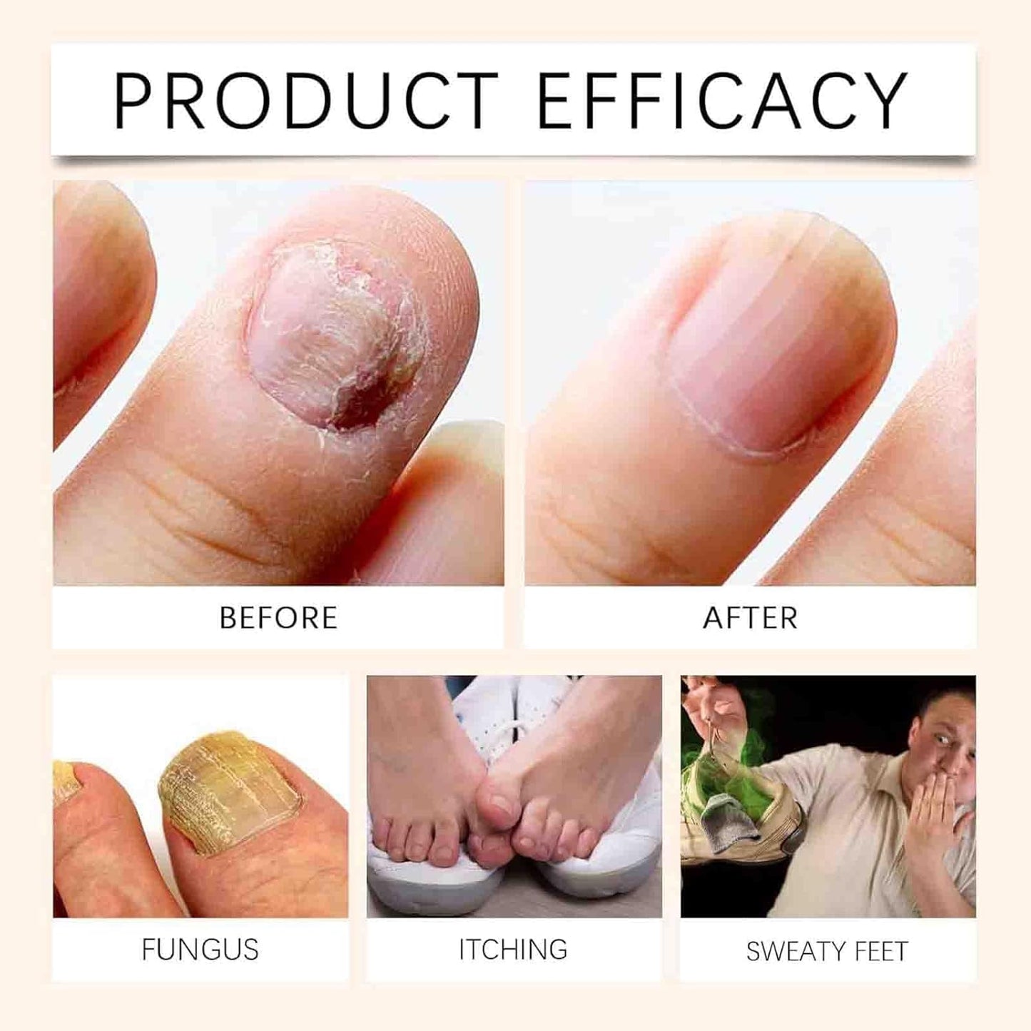 Bee Venom Nail Soothing Spray, Bee Venom Nail Care Spray, Bee Venom Spray for Women and Men (1pcs)