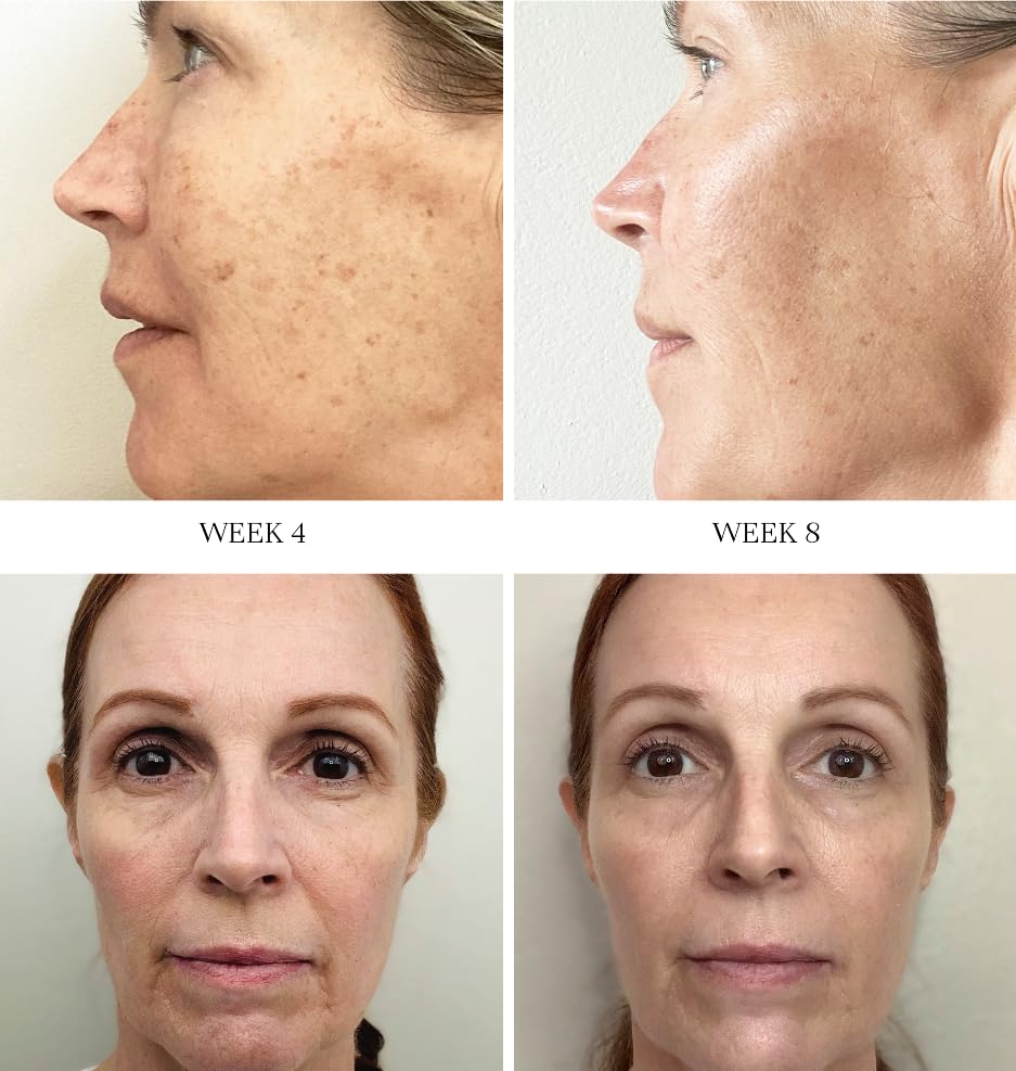 City Beauty Advanced Retinol System - 2 Anti-Aging Face Serums - Retinol & Vitamin C - Firm, Smooth & Brighten - Solution for Wrinkles, Dark Spots, & Sagging - Cruelty-Free Skin Care