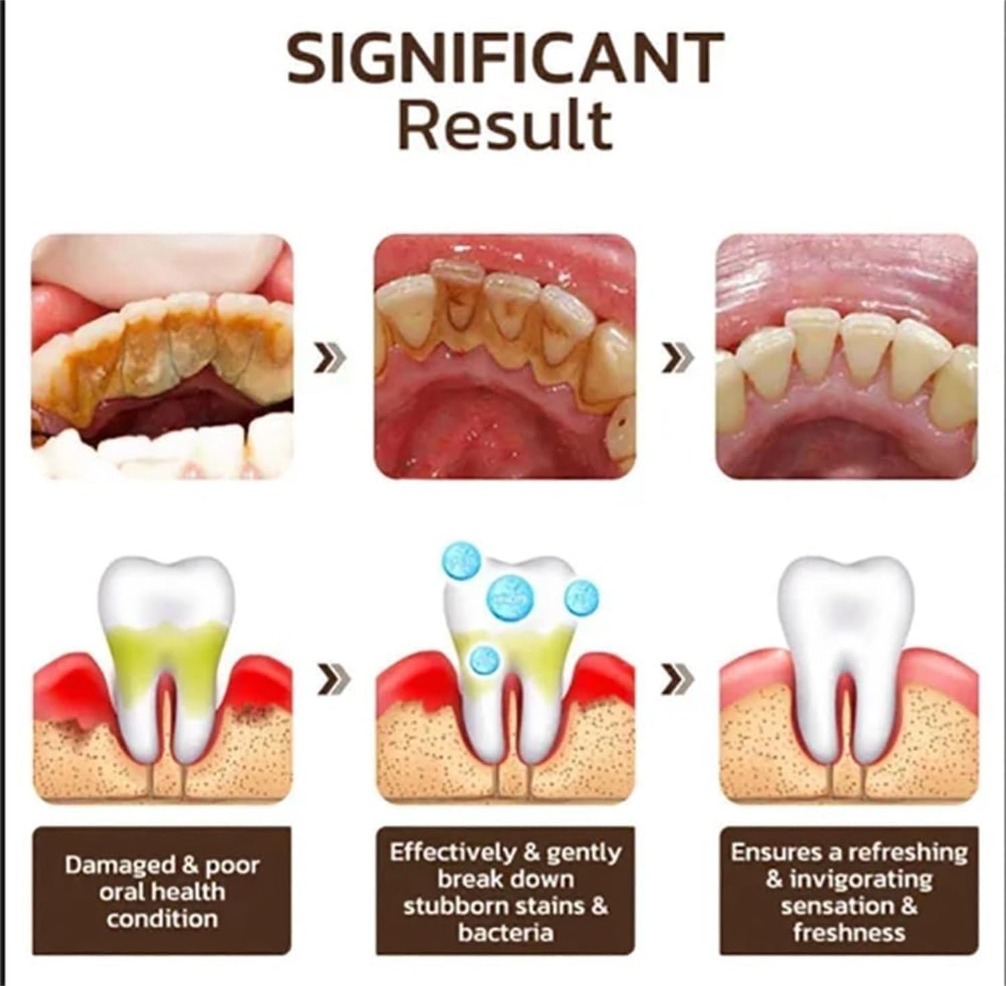 Acssart Toothpaste,Acssart Radiant Whitening Toothpaste,Niacinamide Whitening Toothpastes,Repair and Protect Teeth,Remove Tooth Stains,Daily Oral Care (2)