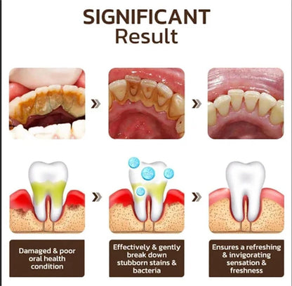 Acssart Toothpaste,Acssart Radiant Whitening Toothpaste,Niacinamide Whitening Toothpastes,Repair and Protect Teeth,Remove Tooth Stains,Daily Oral Care (2)