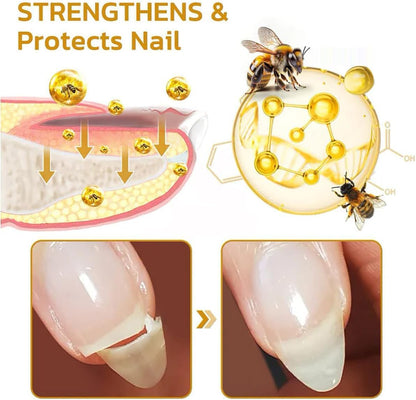 3Pcs Nailplus Strong 7 Days Growth Nail Gel,Nail Growth and Repair Serum,Nail Growth and Strengthener Essence,Nail Strengthener for Damaged Nails