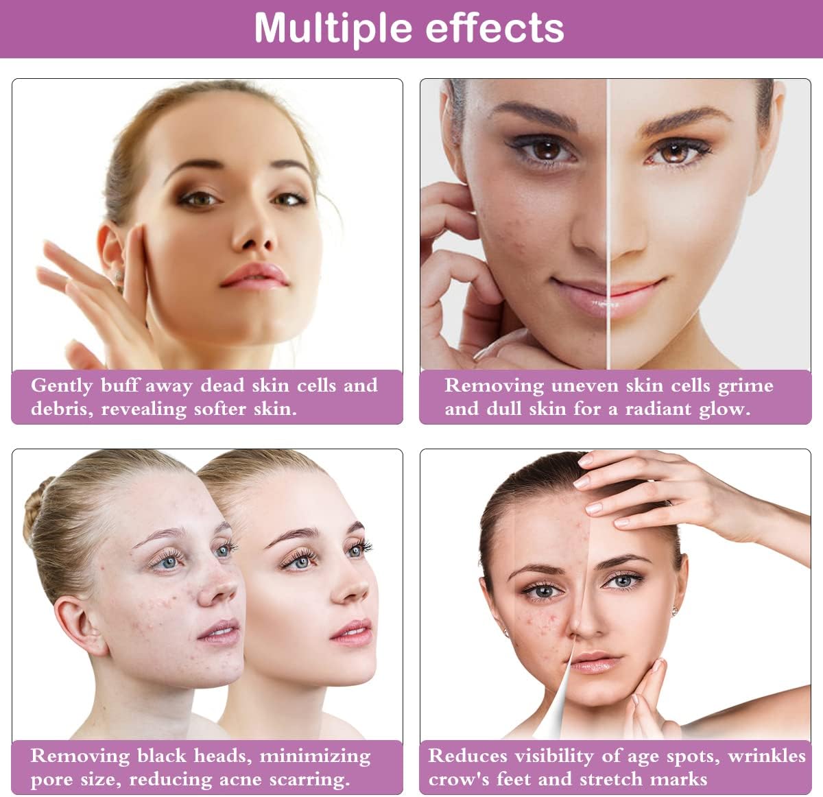 Diamond Microdermabrasion Machine, Yofuly 65-68cmHg Suction Power Professional Dermabrasion, Home Use Facial Skin Care Equipment