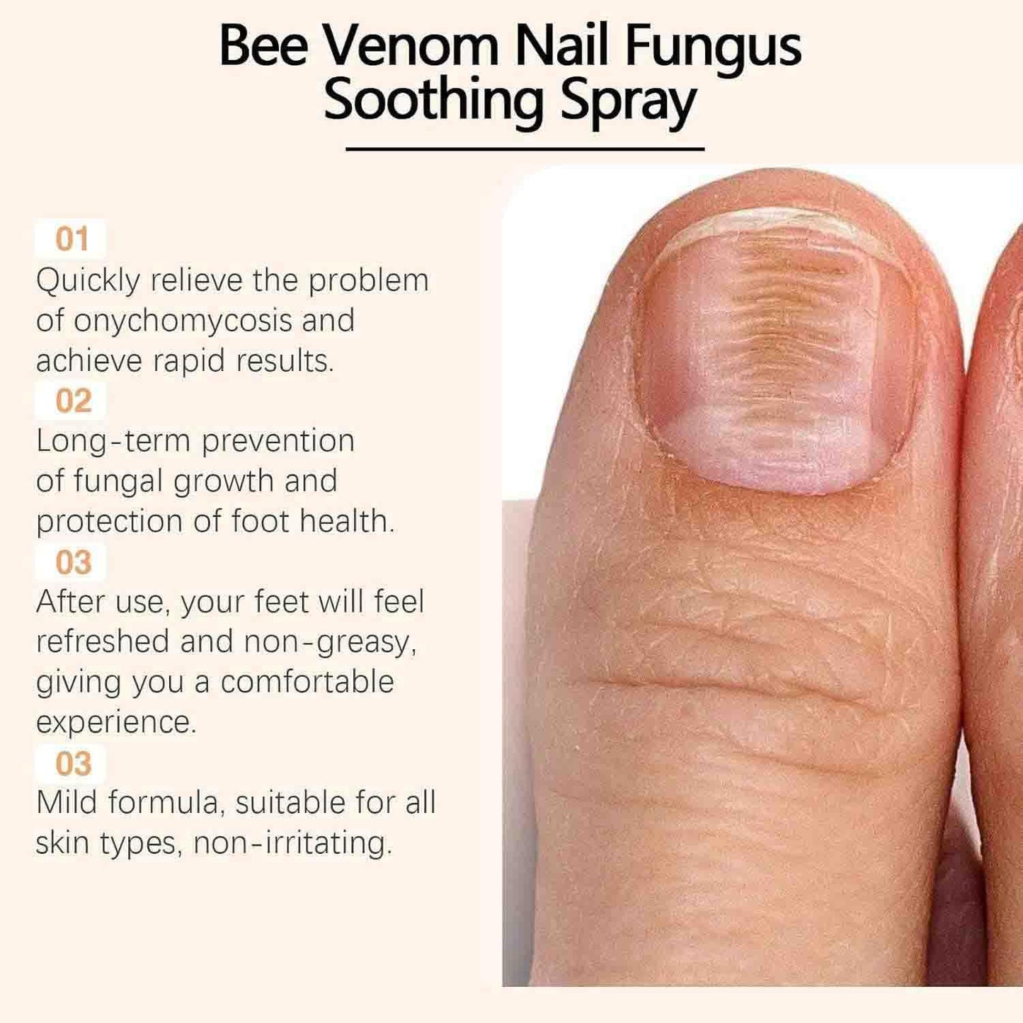 Bee Venom Nail Soothing Spray, Bee Venom Nail Care Spray, Bee Venom Spray for Women and Men (1pcs)