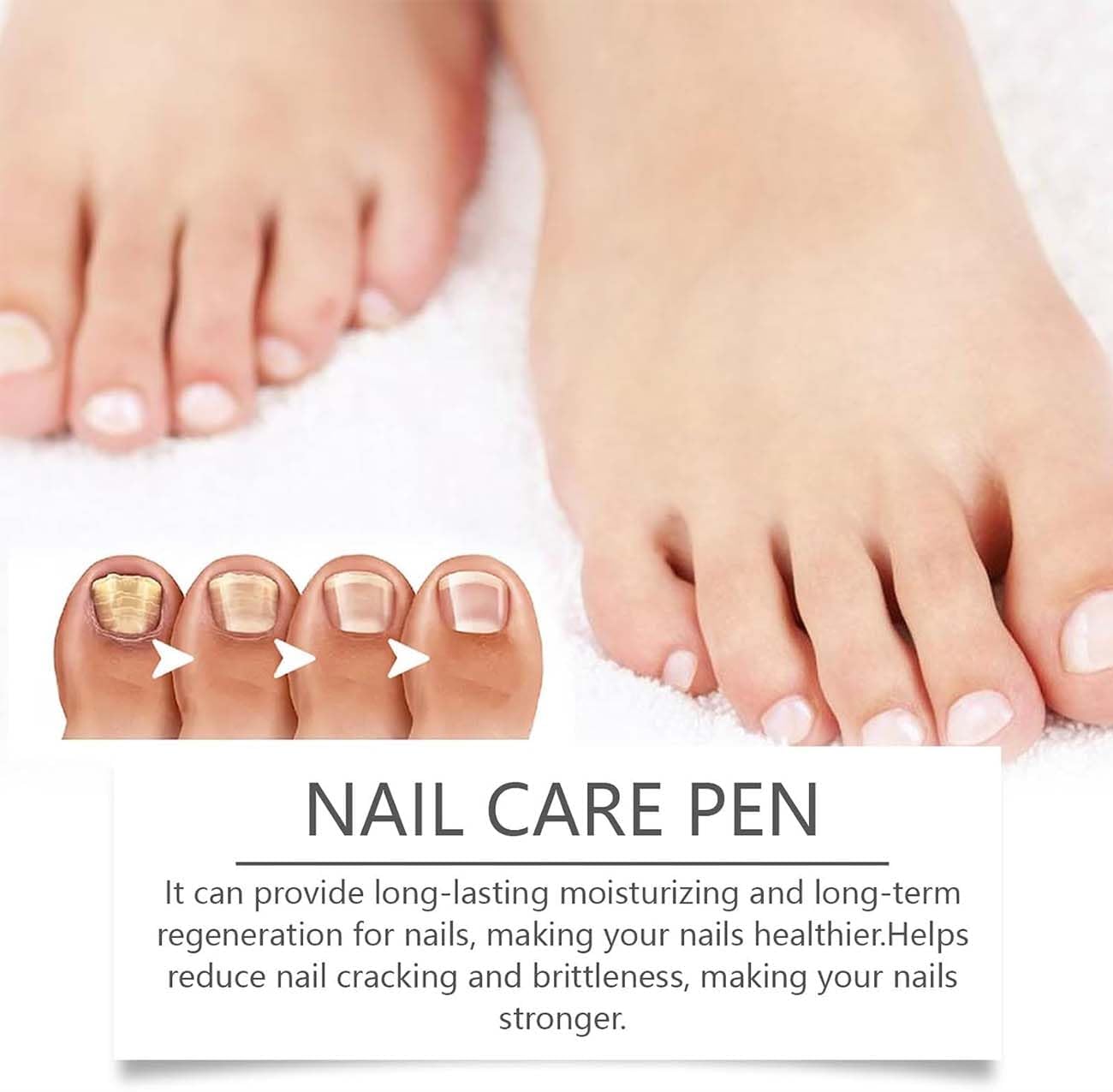 Swissclear - Antifungal Pen,Nail Care Pen,Fungal Nail Pen,Anti Fungal Nail Treatment,Natural Ingredients Toe Nail Fungal Serum for Strengthener,Repairs Cracks,and Corrects Deformed Nails (2)