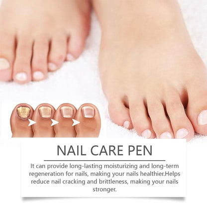 Swissclear - Antifungal Pen,Nail Care Pen,Fungal Nail Pen,Anti Fungal Nail Treatment,Natural Ingredients Toe Nail Fungal Serum for Strengthener,Repairs Cracks,and Corrects Deformed Nails (2)