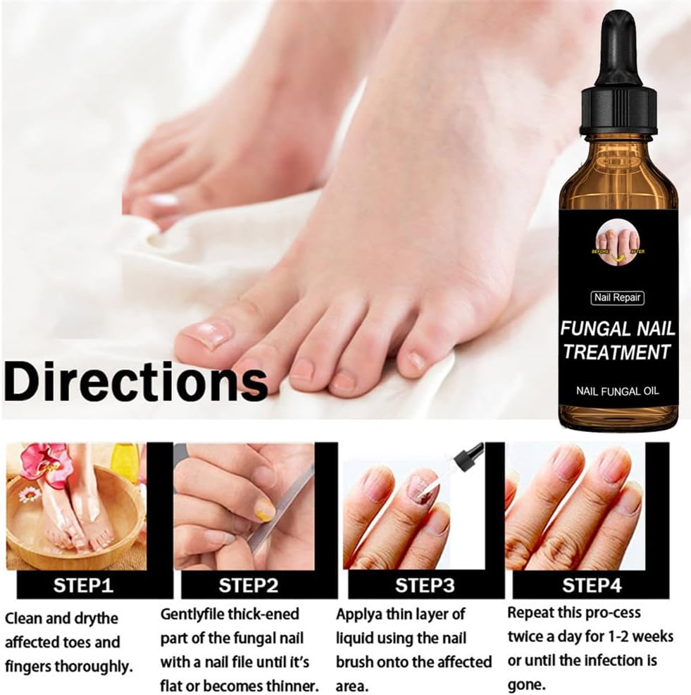 2pcs Nail Care Solution, Improves Brittleness & Discoloration, Cuticle Protection & Strengthening, Repair and Moisturise Nail Nutrient Care Solution, For Toenail And Fingernail