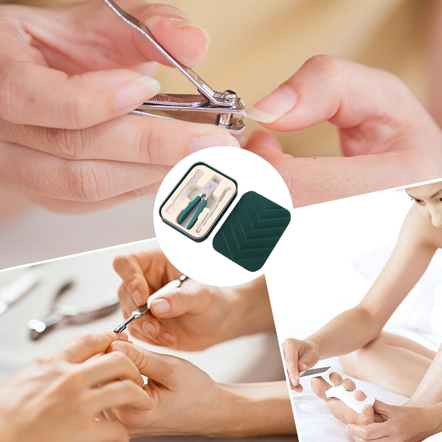 Lmyit Nail Trimmer For Women | Anti-Splash Ingrown Nail Trimming Tool with File and Spoon | Wide Jaw Opening Slanted Tool For Women Men Seniors Elderly Adults Pedicure