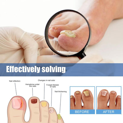 Nail Repair Patches, 60 Pieces Long-Lasting Nails Care Patch, 20g Breathable Toenail Sticker, Ideal for Recovery Restoration, Home, Travel, Adults, Professional, Beginners