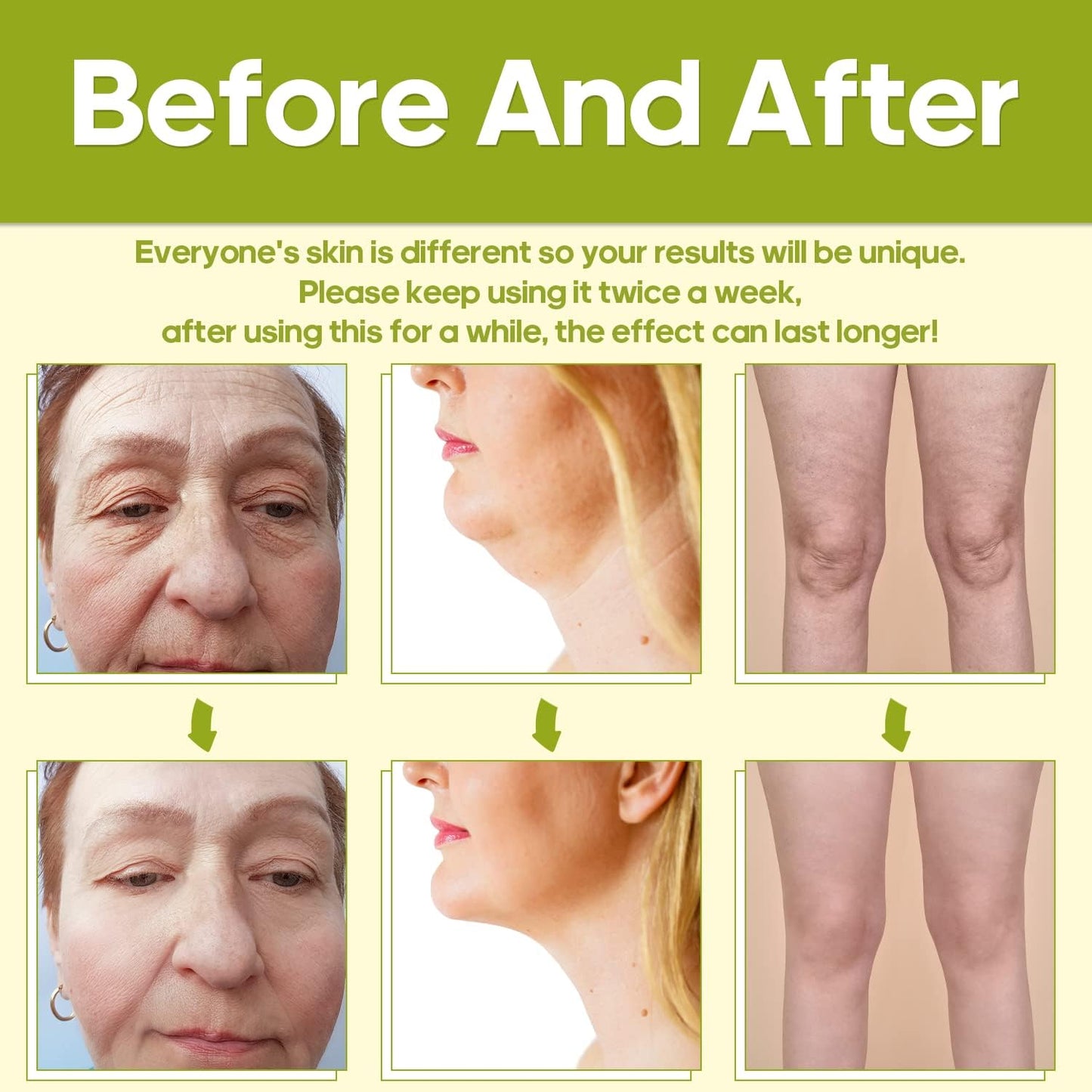Radio Frequency Skin Tightening Machine - TUMAKOU Home Use RF Facial Device for Skin Tightening & Rejuvenation - Professional Salon Skin Care Body Facial Massager