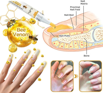 3Pcs Nailplus Strong 7 Days Growth Nail Gel,Nail Growth and Repair Serum,Nail Growth and Strengthener Essence,Nail Strengthener for Damaged Nails