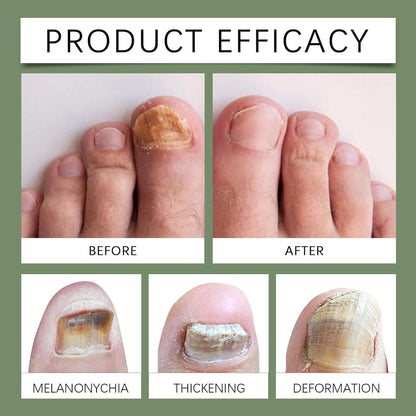 Nail Care Products, Moisturizer Growth Corrector, Quick Absorb and Effective Nail Formula, Professional Quality, Ideal for Women, Seniors, Home Use, Salon, Travel, 30ml