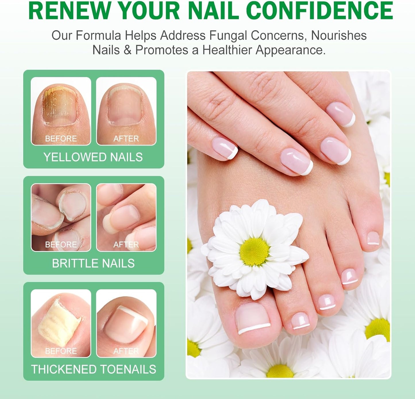 7 Day Nail Fungus Treatment | Natural Plant-Based Nail Repair Oil with Ginger Extract | Strengthens & Nourishes Nails & Cuticles | Repairs Discolouration & Brittleness | Suitable for Hands & Feet | 60mL