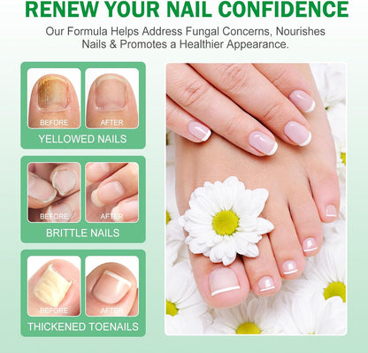 7 Day Nail Fungus Treatment | Natural Plant-Based Nail Repair Oil with Ginger Extract | Strengthens & Nourishes Nails & Cuticles | Repairs Discolouration & Brittleness | Suitable for Hands & Feet | 60mL